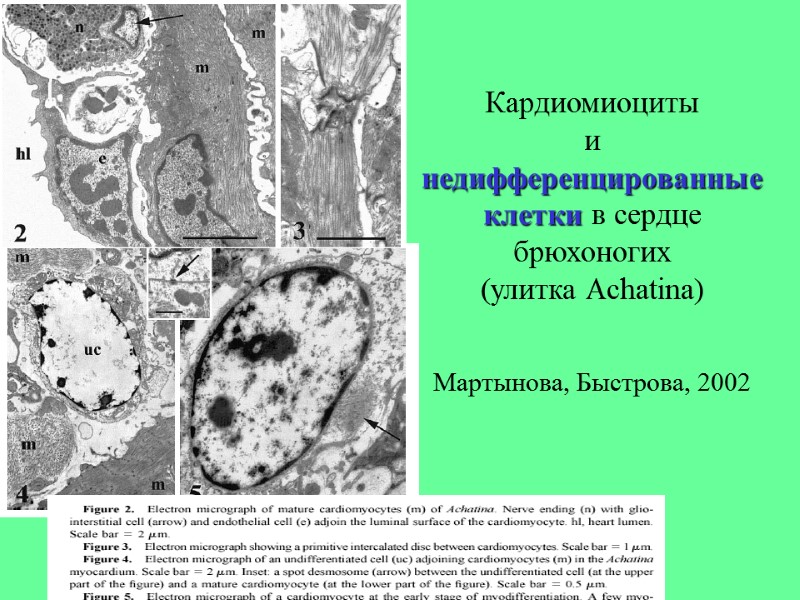 Кардиомиоциты и недифференцированные клетки в сердце брюхоногих (улитка Achatina)  Мартынова, Быстрова, 2002